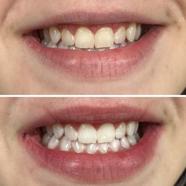 $25 off one whitening session at Religion Beauty & Tattoo in Vancouver, WA